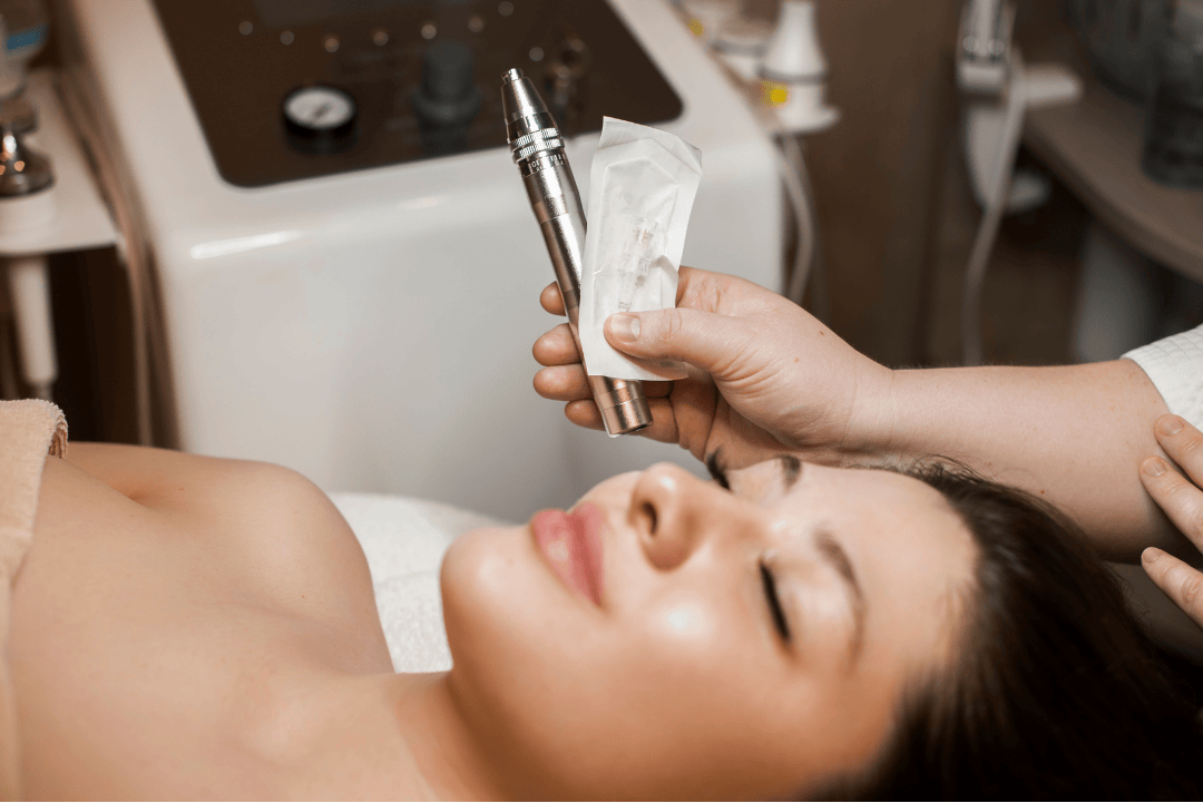 Microneedling Therapy