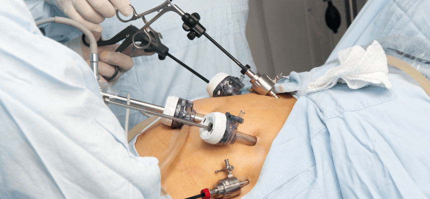  Minimally Invasive Surgery