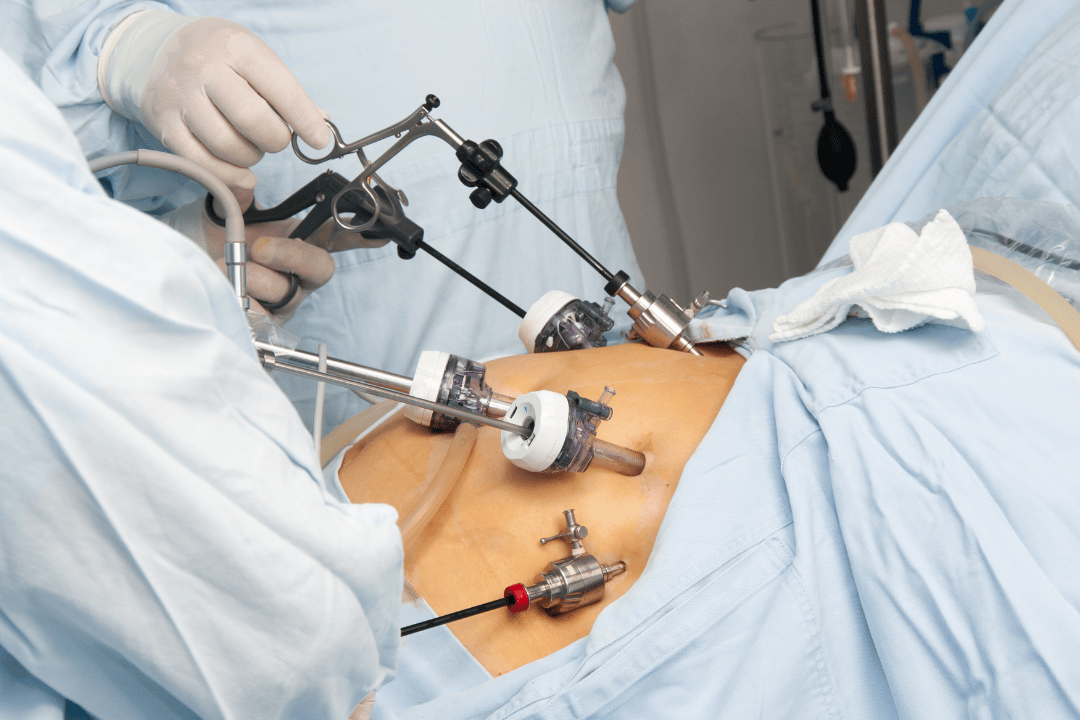  Minimally Invasive Surgery