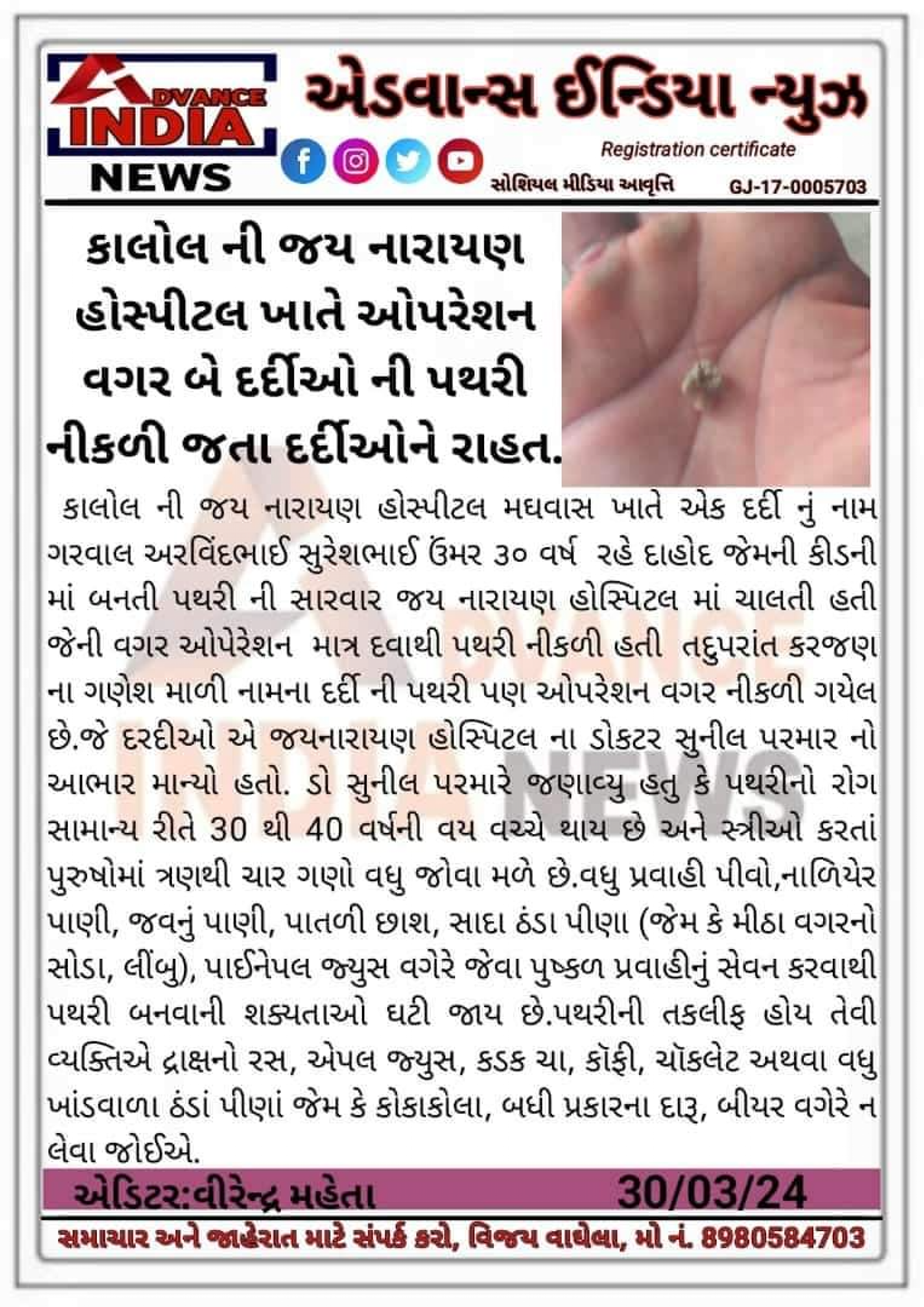 ઓપેરેશન વગર પથરી નીકળી 