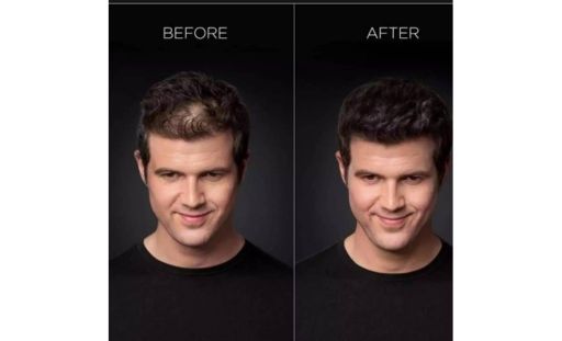 Instant Results, Zero Downtime